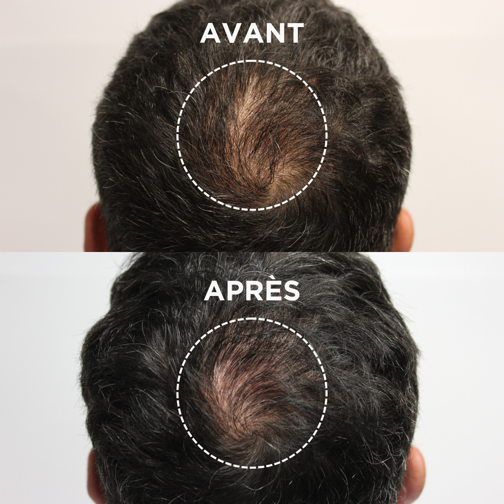 THICKER HAIR SERUM (Sérum anti-chute densifiant)
