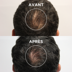 THICKER HAIR SERUM (Sérum anti-chute densifiant)