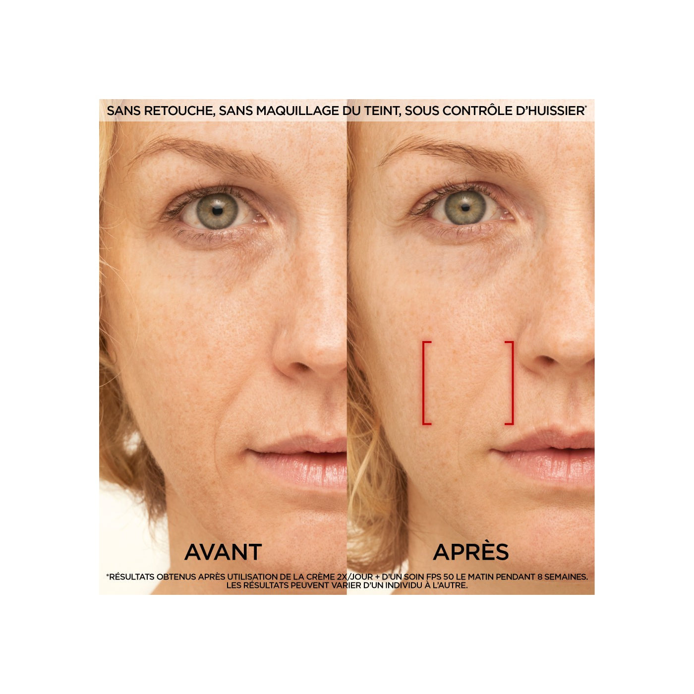 Revitalift Laser Anti-Aging Day Treatment