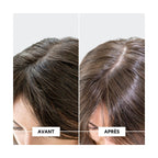 Oily Dandruff & DS Protocol