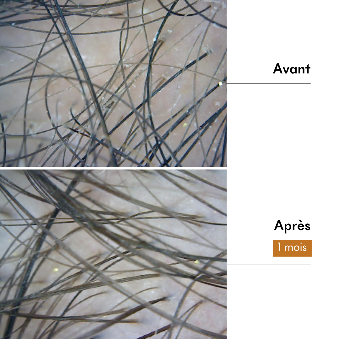 Fine Hair Protocol