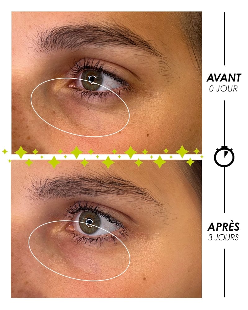 Garancia Laboratory GHOST TEARS Eye Contour