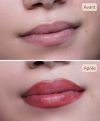 Maquillage Permanent - Lèvres Remplissage - Soin En Institut