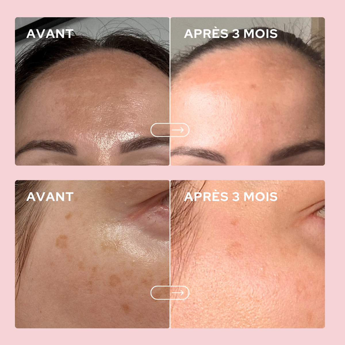 Dúo Piel Bella