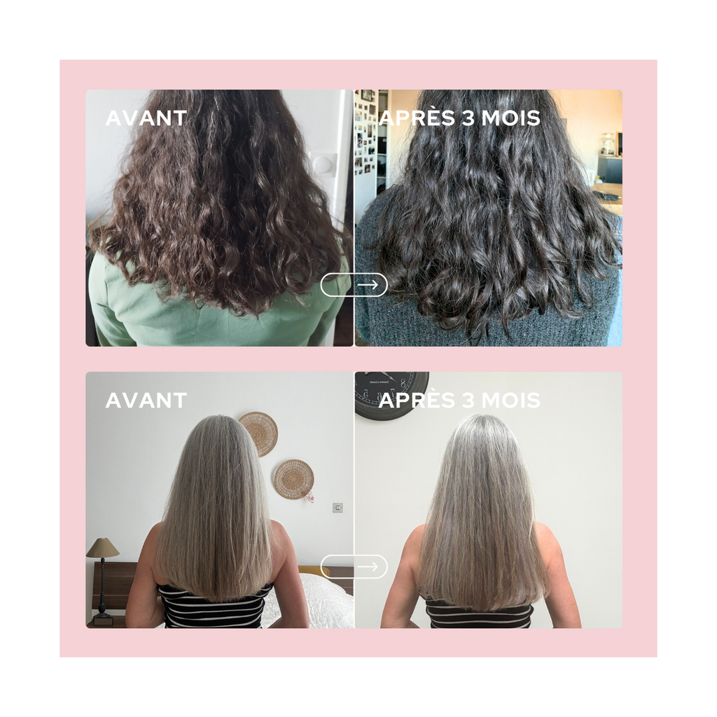 Gummies Cheveux & Ongles