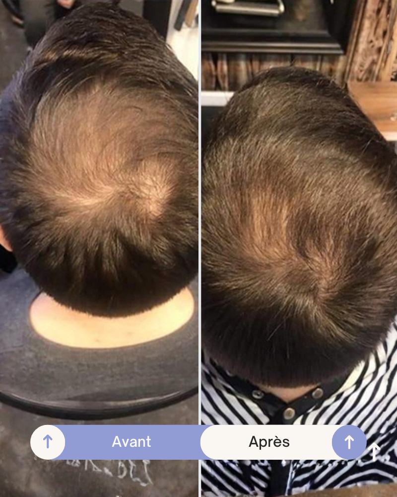 Grow Perfect™ Thickening Mousse