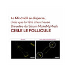 Protocole Anti-Chute Tricho-Boost