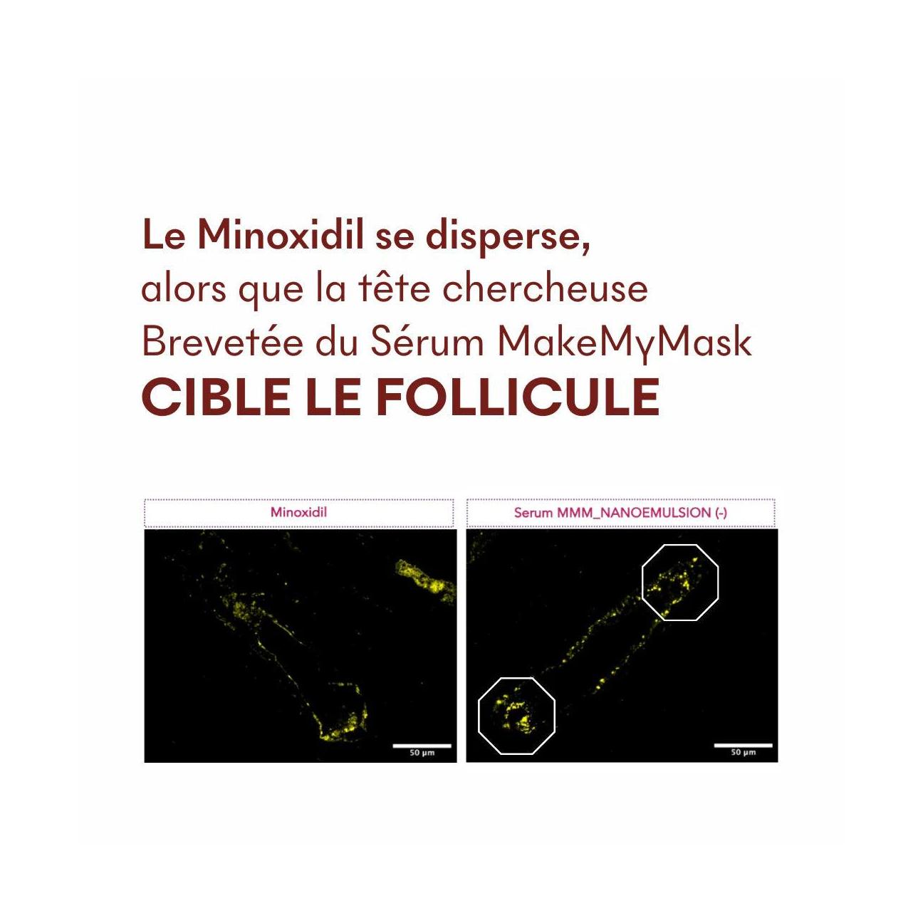 Protocole Anti-Chute Tricho-Boost