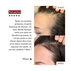 Anti-Hair Loss Serum Tricho-Boost
