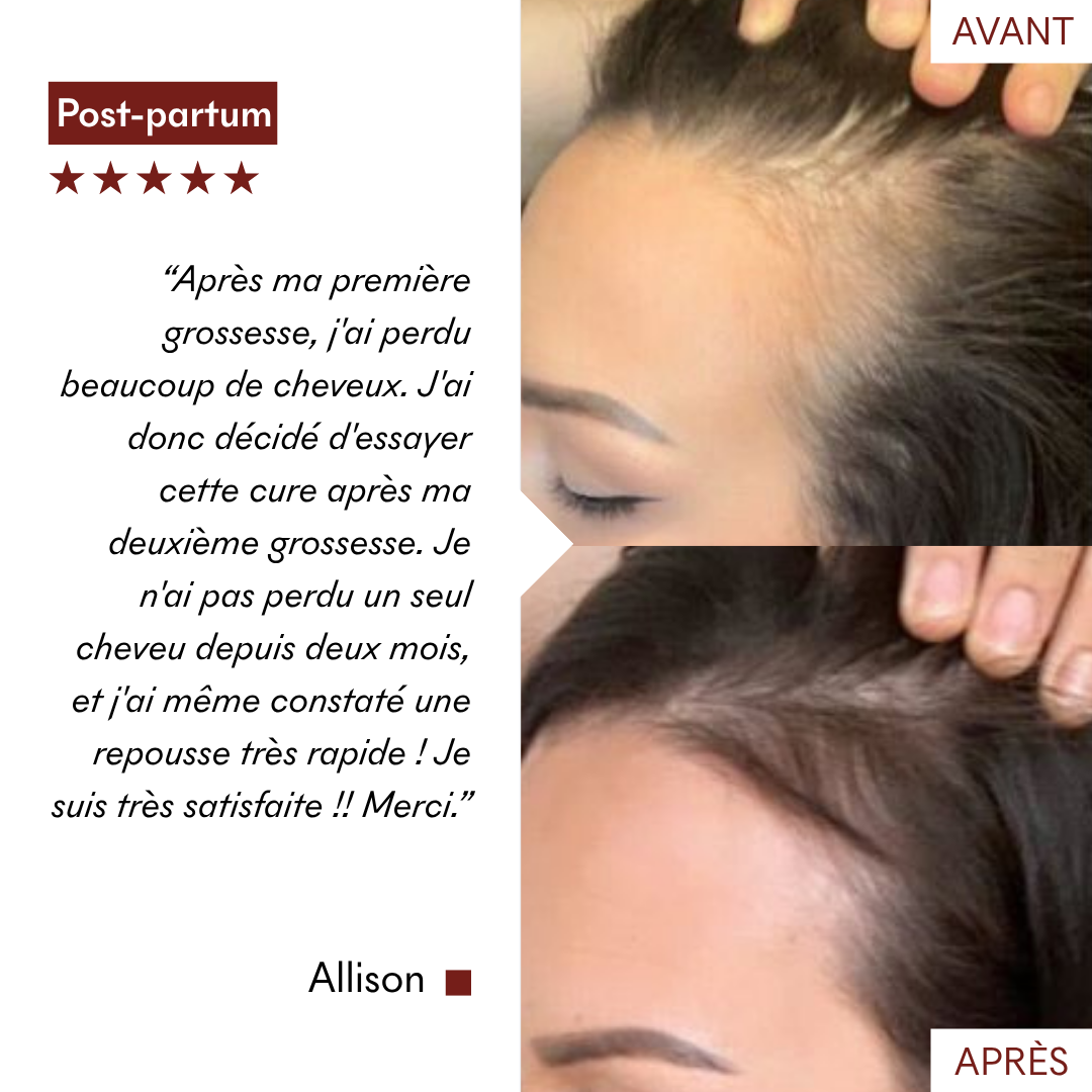 Reactive Hair Loss Protocol