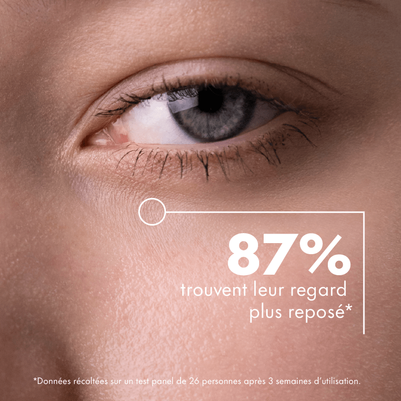 Revitalising eye contour treatment - Clémence & Vivien