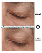 Antes-después contorno de ojos antiedad monoexperto Laboratoire Garancia