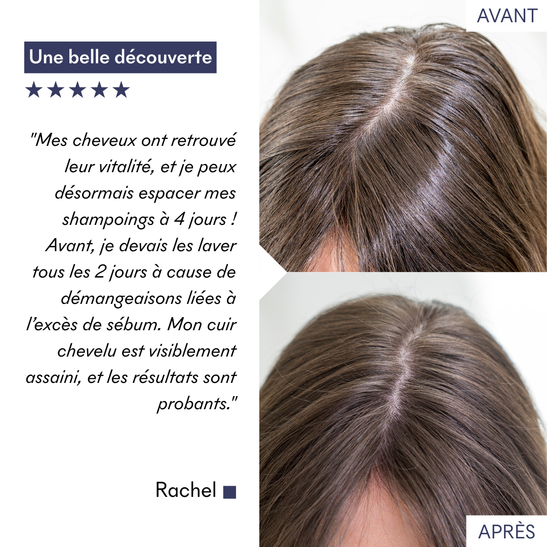 Shampoing Cheveux Gras Tricho-Détox Ph5