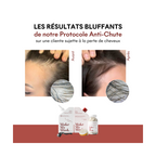 Shampoing Anti-Chute Tricho-Force Ph5