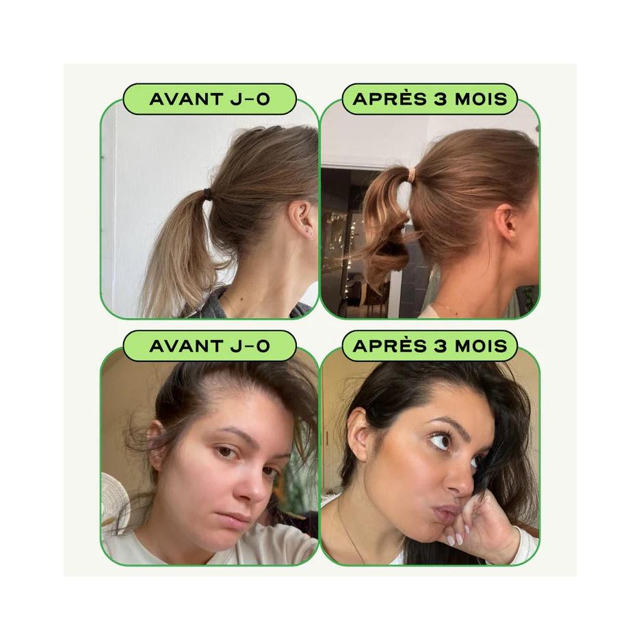 Crecer – Salud y crecimiento del cabello