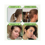 Crecer – Salud y crecimiento del cabello