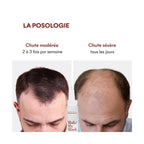Anti-Hair Loss Serum Tricho-Boost