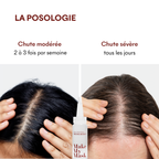 Protocole Anti-Chute Hormonale