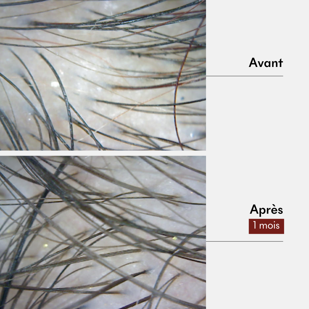 Boue Pousse & Anti-Chute