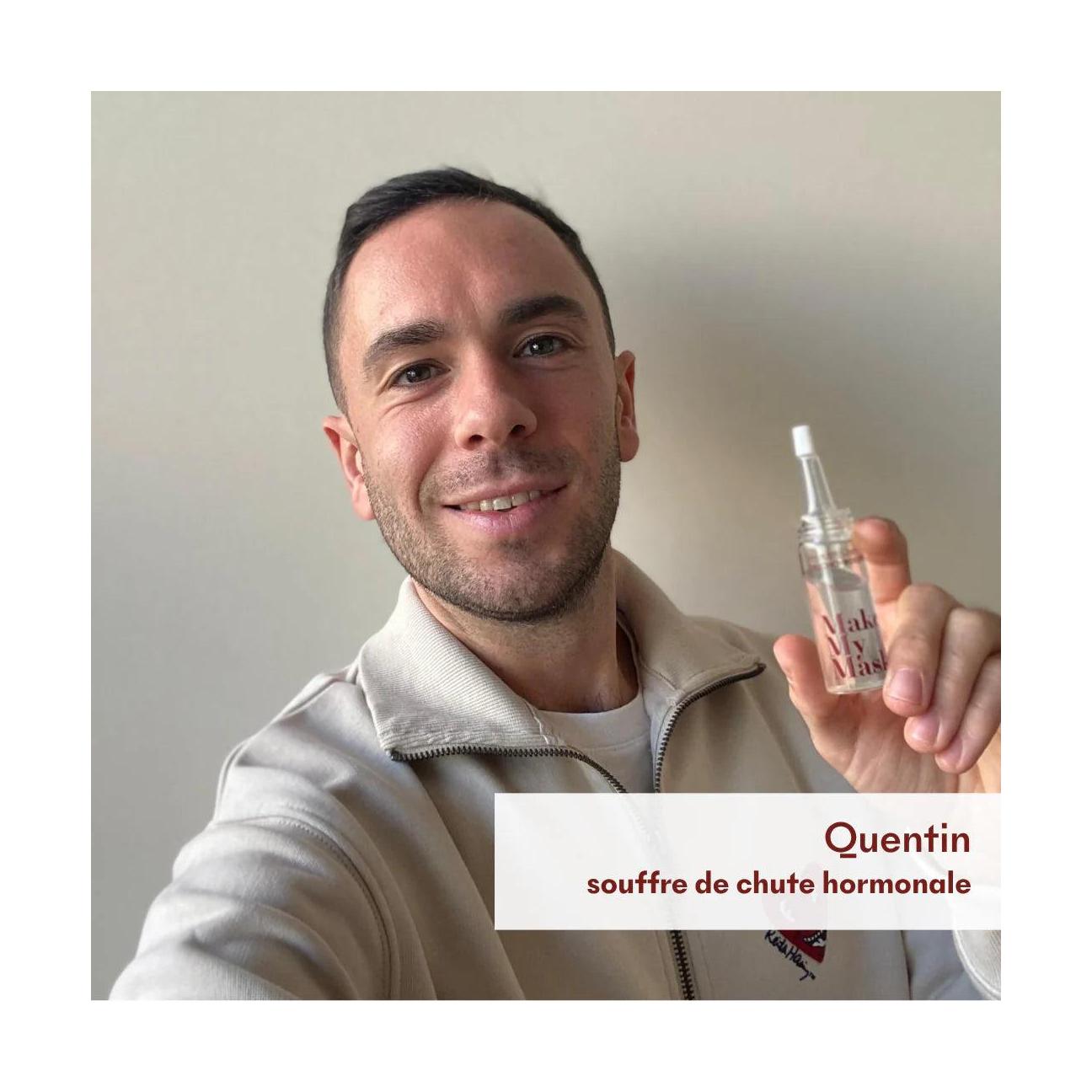Anti-Hair Loss Serum Tricho-Boost