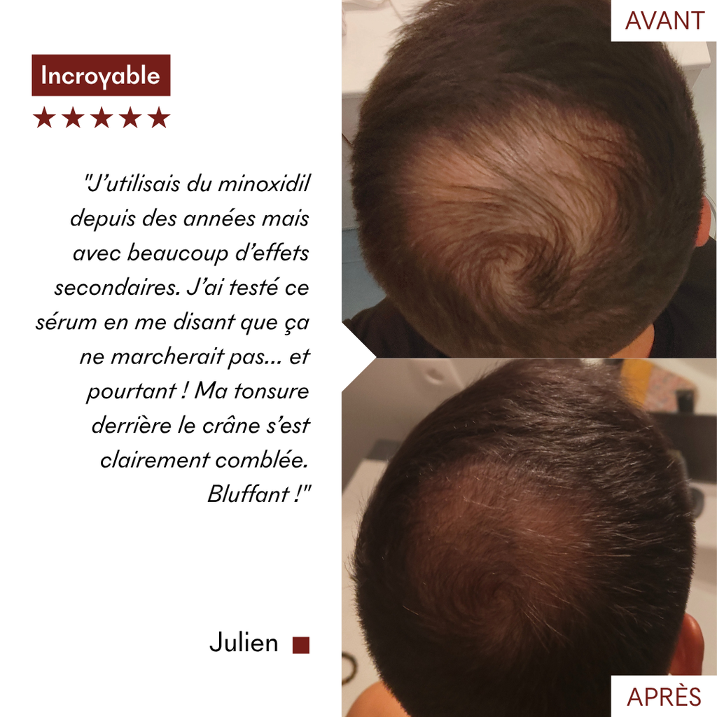 Sérum Anticaída Tricho-Boost