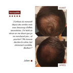 Anti-Hair Loss Serum Tricho-Boost
