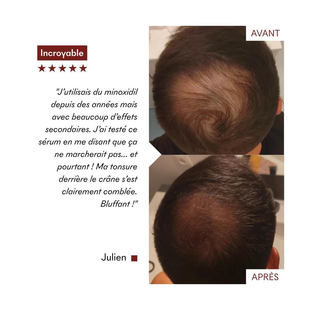 Anti-Hair Loss Serum Tricho-Boost