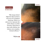 Anti-Hair Loss Serum Tricho-Boost