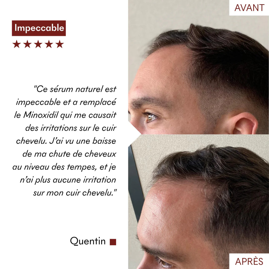 Protocolo anticaída Tricho-Boost
