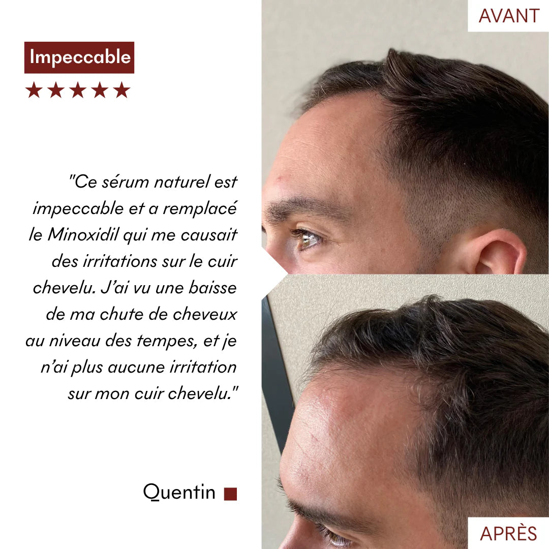 Protocolo anticaída Tricho-Boost