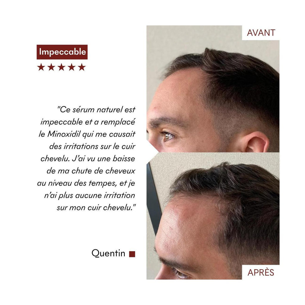 Anti-Hair Loss Serum Tricho-Boost